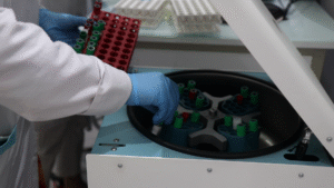 تحاليل مخبرية دقيقة في مخبر فاطمة الطبي