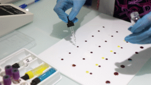 فحوصات الدم ضمن التحاليل المخبرية